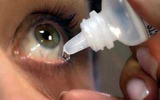 Какие правила нужно соблюдать, чтоб правильно закапать капли в глаза?