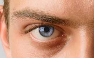 Симптомы врожденной глаукомы, диагностика и лечение недуга