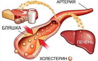 Лимон и чеснок – лучшие продукты для снижения холестерина