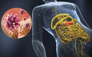 Диарея и рвота – причины и лечение