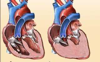 Последствия передозировки капотеном