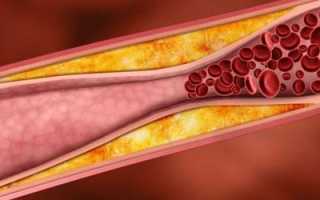 Синильная кислота: симптомы и лечение отравления