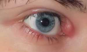 Влияние ячменя на плод во время беременности