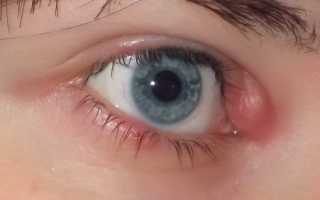 Влияние ячменя на плод во время беременности