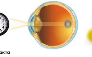Виды и степени катаракт, профилактика избежания недуга