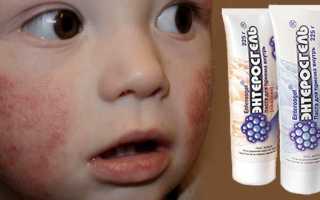 Как использовать энтеросгель грудничку