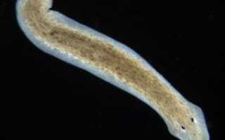 Чем лечить глисты у ребенка