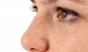 Методы коррекции зрения при близорукости