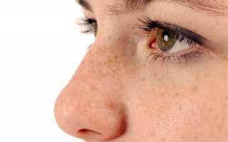 Методы коррекции зрения при близорукости