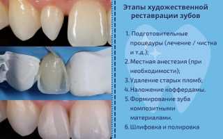 Что такое реставрации зубов и как она проходит