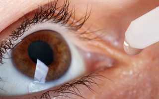 Дальнозоркость, особенности заболевания