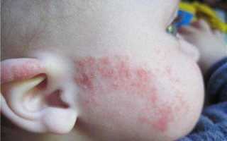 Почему у ребенка бывает зеленый понос