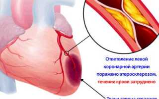 Передозировка и смерть от анаприлина
