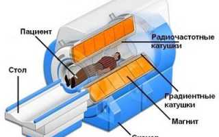 Какой вред оказывает компьютерная томография
