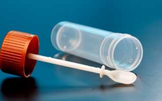 Как сдают анализы на глисты и какой паразит может быть причиной плохого самочувствия?