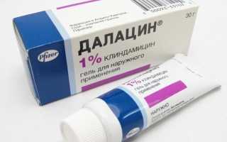 Вросший волос в зоне бикини