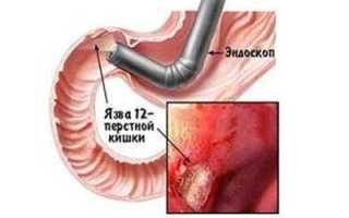 Совмещение дротаверина с алкоголем