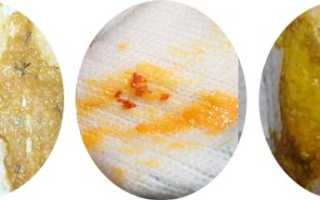 Черные ниточки в кале – что это, причины появления