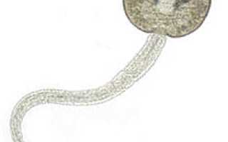 Зуд купальщика или церкариальный дерматит