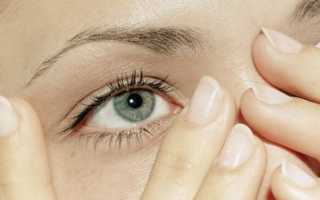 Домашние способы лечения покрасневших глаз