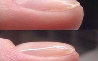 Есть ли вред от гель-лака для ногтей