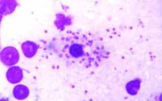 Опасный эндемик южноамериканских тропиков — Leishmania brasiliensis