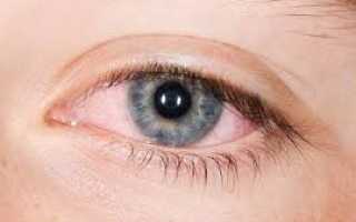 Аденовирусный конъюнктивит: виды, особенности лечения