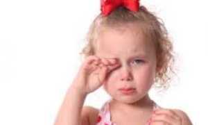 Аллергический конъюнктивит у ребенка: лечение, профилактика