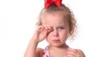 Аллергический конъюнктивит у ребенка: лечение, профилактика