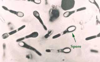 Длительность пищевого отравления у детей и взрослых