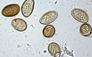 Яйца аскарид в организме человека