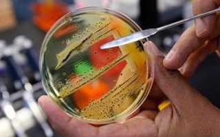 Водянистый понос – причины и особенности лечения