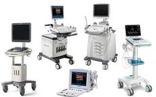 Какие бывают УЗИ аппараты
