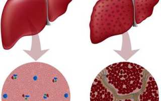 Печеночный сбор для очищения печени