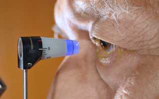 Что нужно для получения инвалидности при глаукоме