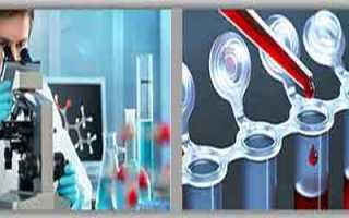 Анализ крови на аскаридоз, расшифровка и виды анализов, цена