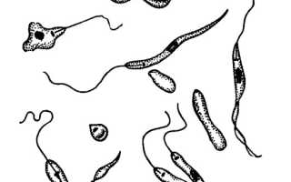 Жгутиконосцы паразиты: примеры и чем они опасны