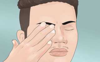 Заболевания глаз