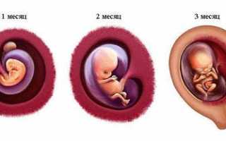 Почему появляется рвота с примесями желчи