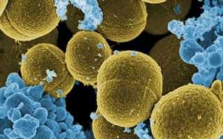 Что принимать при отравлении пищей в домашних условиях