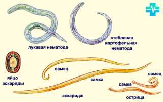 Яйца остриц. Какие размеры и какие признаки острицы?