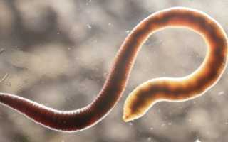 Как сдать анализ на энтеробиоз для бассейна