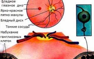 Можно ли совмещать нитроглицерин с алкоголем