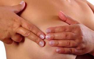 Лечение гнойного мастита