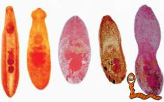 Трематоды в организме человека — виды, симптомы и лечение