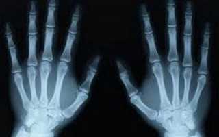 Опасно ли рентгеновское излучение для человеческого организма