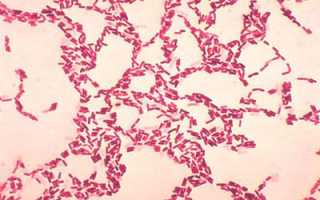 Классификация и симптомы микробных пищевых отравлений