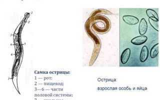 Острицы при беременности: что делать, симптомы и лечение, отзывы