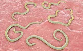 От чего у человека появляются глисты?