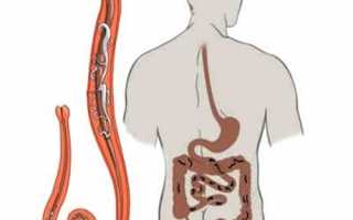 Лучшие средства от паразитов